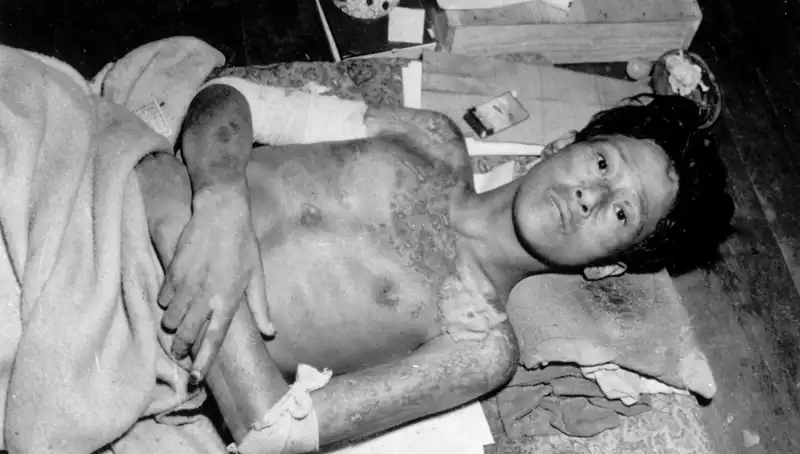 80 Yıl Sonra Nagasaki’den Şok Edici Uyarı: Nükleer Tehdit Yeniden Kapıda!