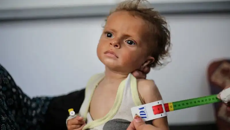 İngiltere'den Gazzeli Çocuklara Umut: 300 Çocuğa Kapılar Açılıyor